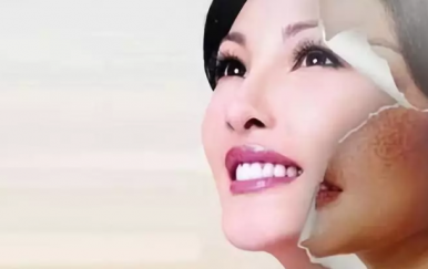 一年中最佳的祛斑時(shí)間，那無疑是秋季。