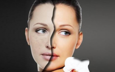 簡單的祛痘方法，讓你的皮膚時刻光滑細(xì)嫩